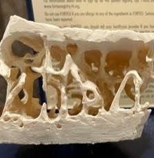 blue tape measure on scale